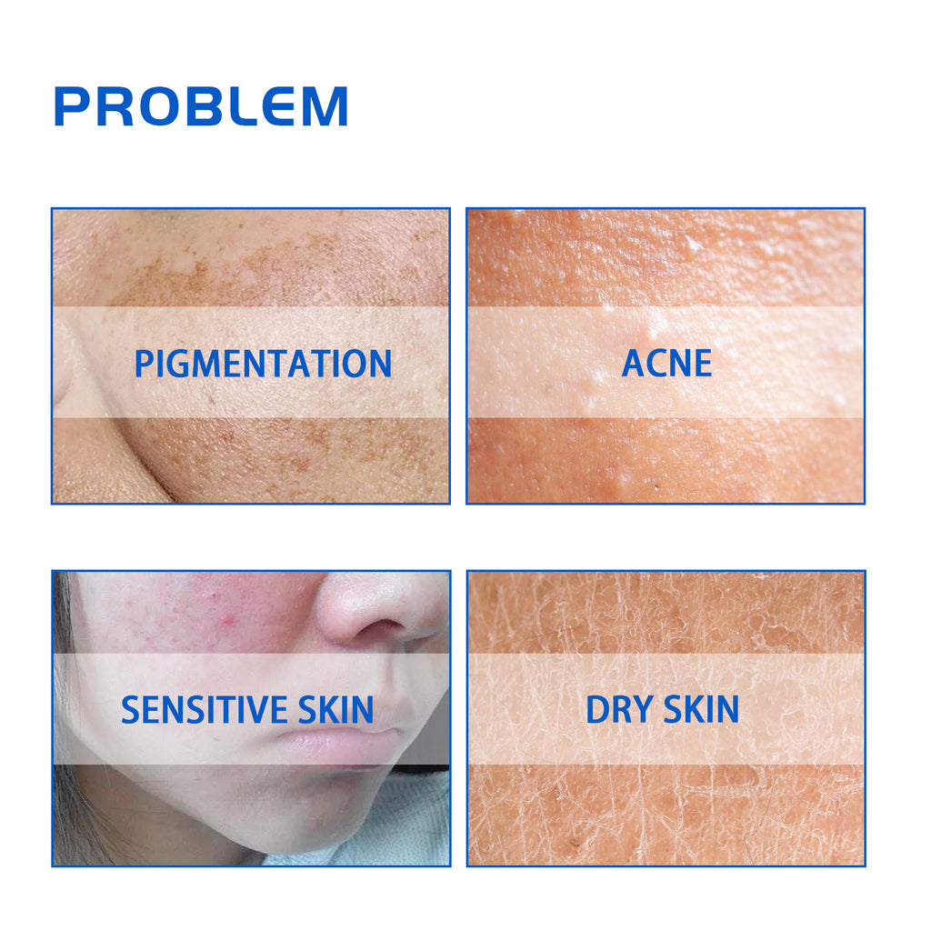 HOYGI Blueberry Anti-Wrinkle Brightening Cream